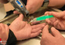D: Ring schnürt Finger ab – Feuerwehr entfernt Ring in der Notaufnahme